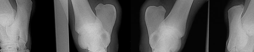 Röntgenaufnahme Gelenk